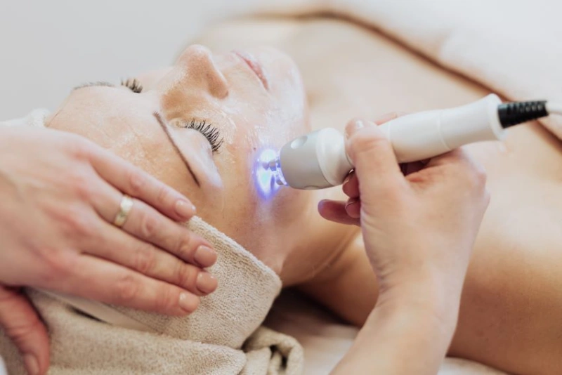 The importance of pre-wedding beauty treatments